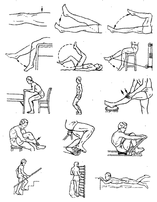 Therapeutic exercises for knee arthrosis joint