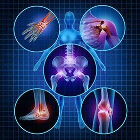 How to facilitate the mobility of joints with arthritis and arthrosis in treatment