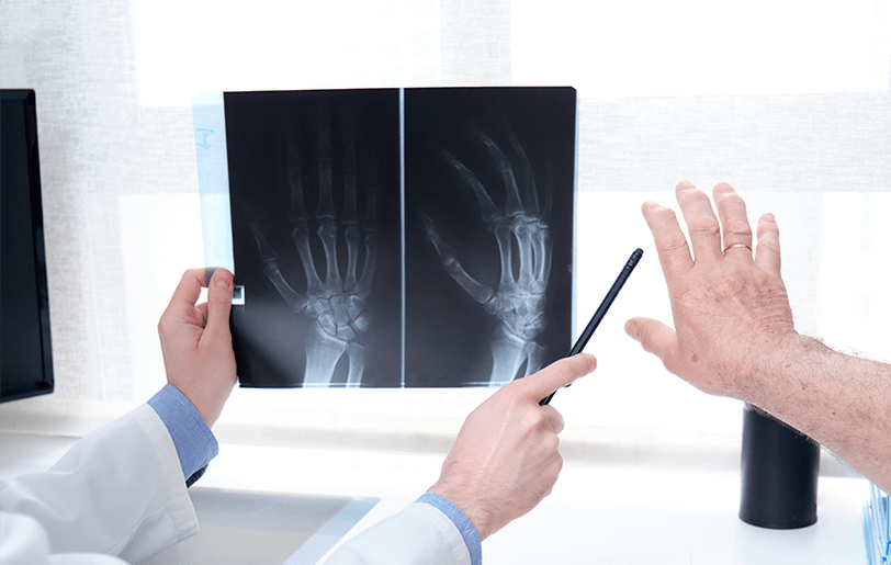 diagnosis of arthrosis of the joints