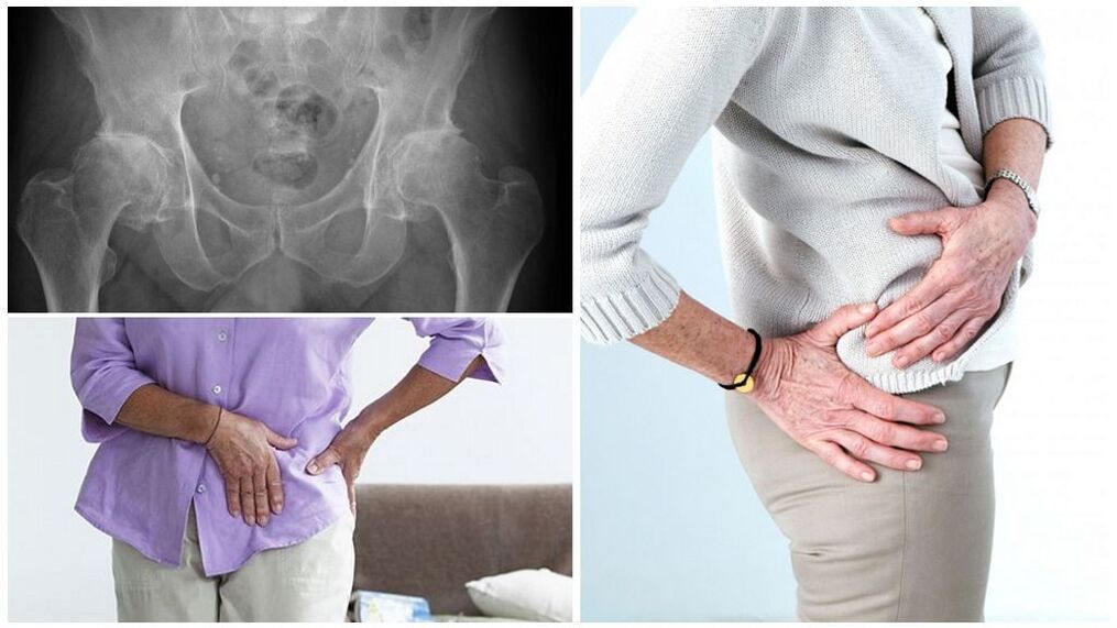 There are many reasons why the pathology is developing
